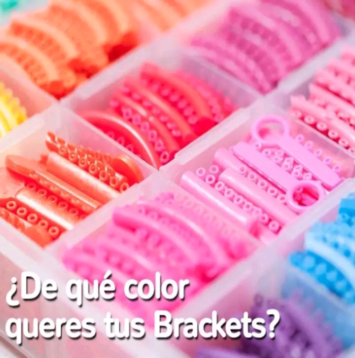 Ligaduras de brackets de distintos colores