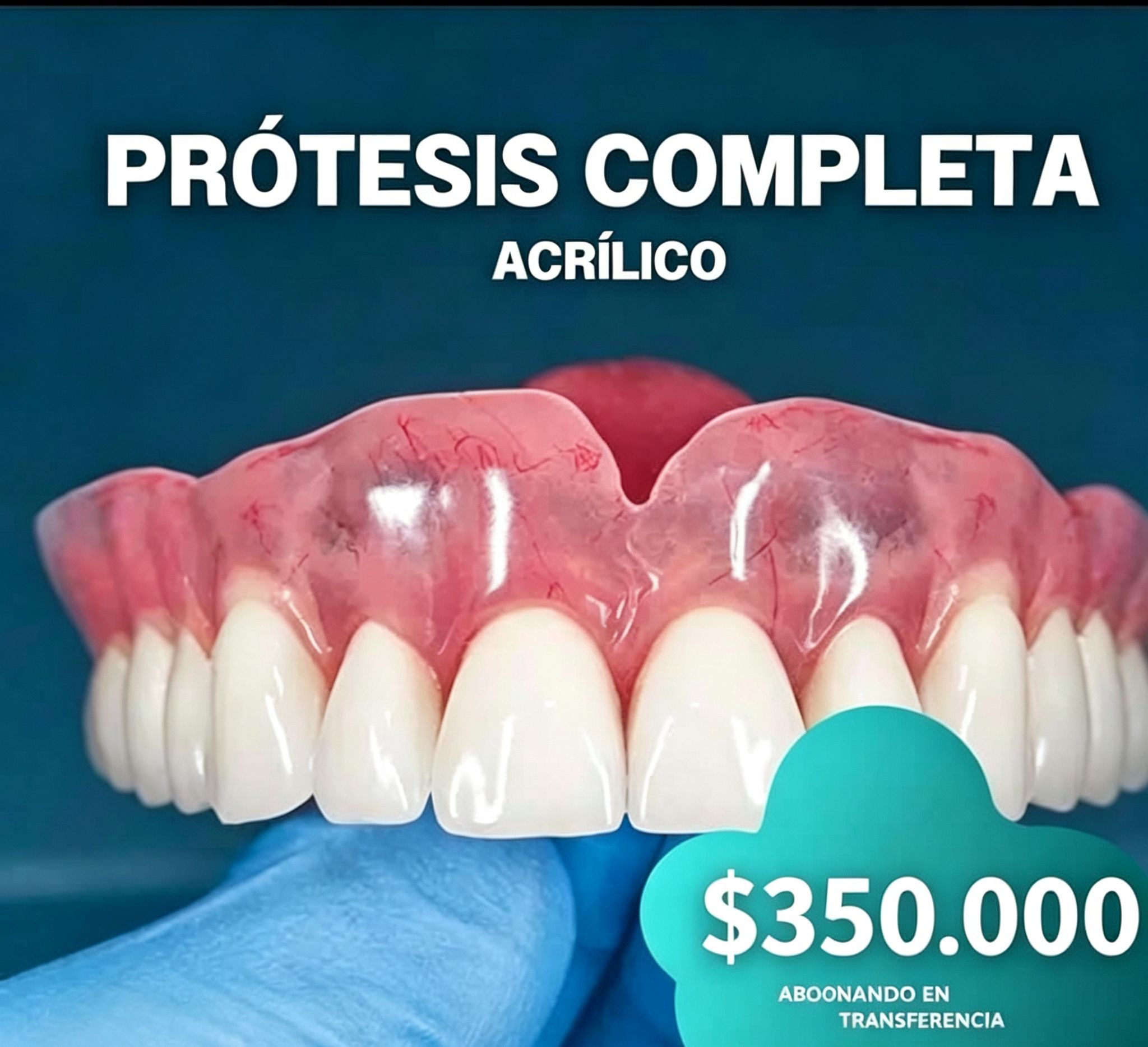 Prótesis dental completa de acrílico mostrando el detalle de la encía y las piezas superiores